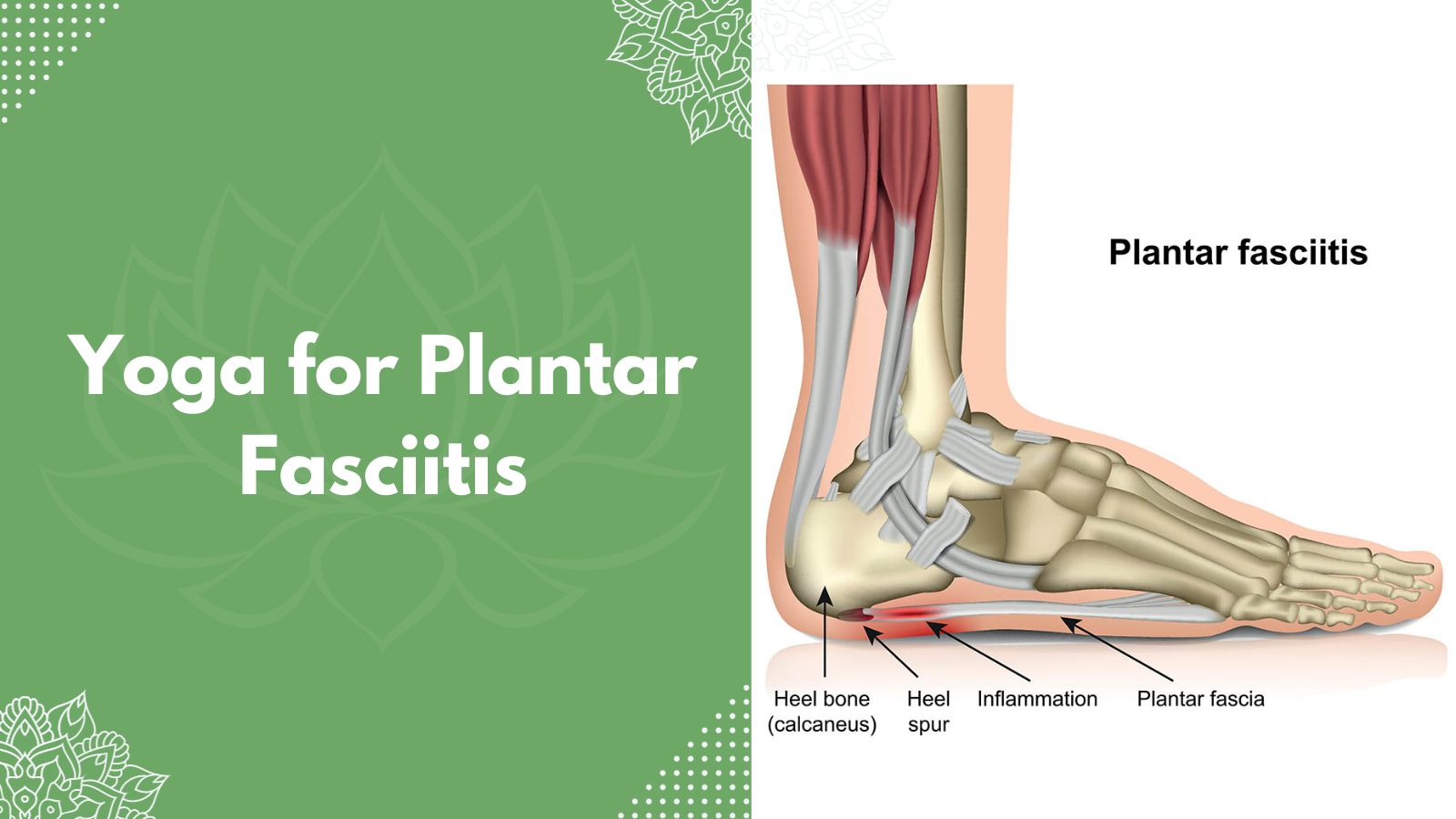 Yoga for Plantar Fasciitis