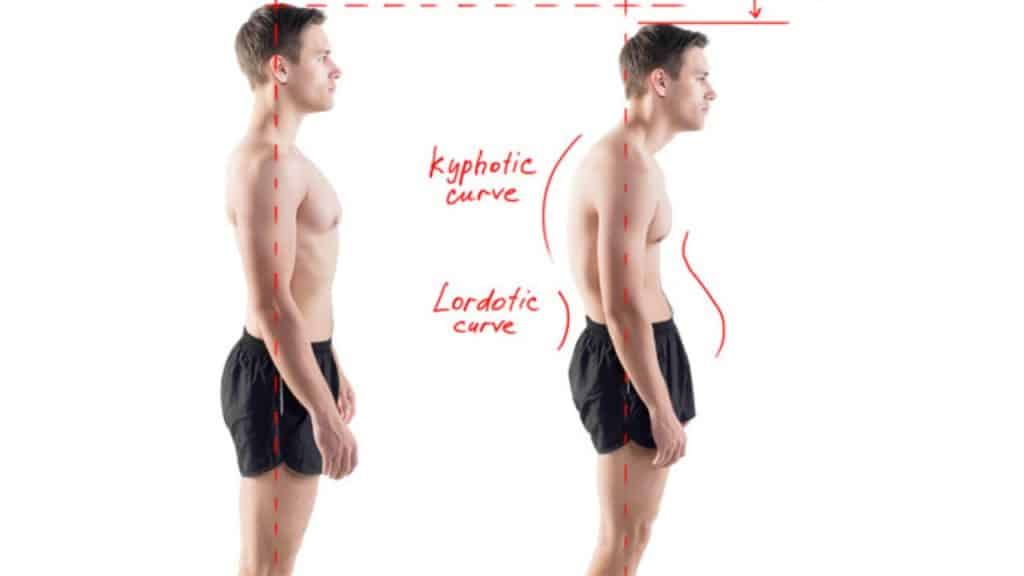 Posture Improvement